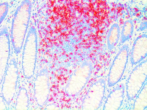 CD3 Antibody Immunohistochemistry on a FFPE Colon Tissue